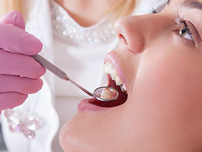 The image shows a person having their teeth cleaned by a dental professional using a mirror for observation.